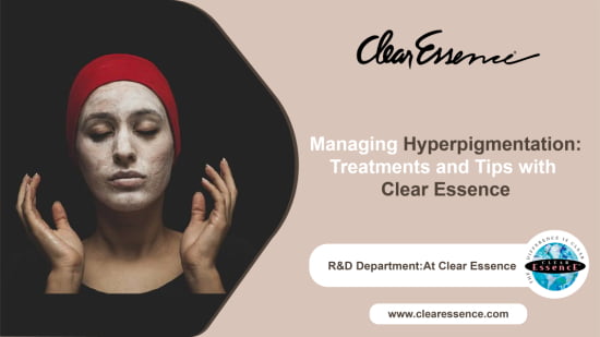 Managing Hyperpigmentation