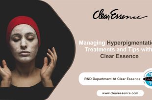 Managing Hyperpigmentation: Treatments and Tips with Clear Essence